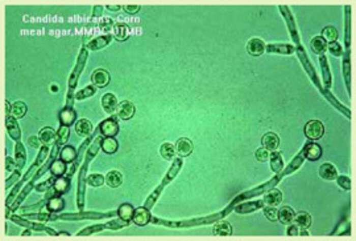Ο μύκητας Candida και η θεραπεία του