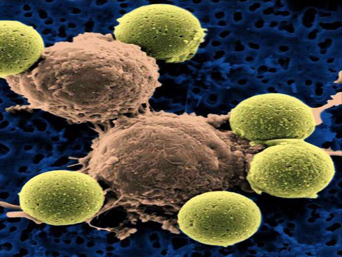 Μεγάλη ανακάλυψη για τη θεραπεία της λευχαιμίας  t cells