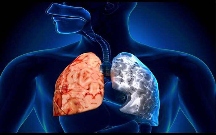 Χρόνια Αποφρακτική Πνευμονοπάθεια ή ΧΑΠ: Τι είναι, συμπτώματα, αντιμετώπιση