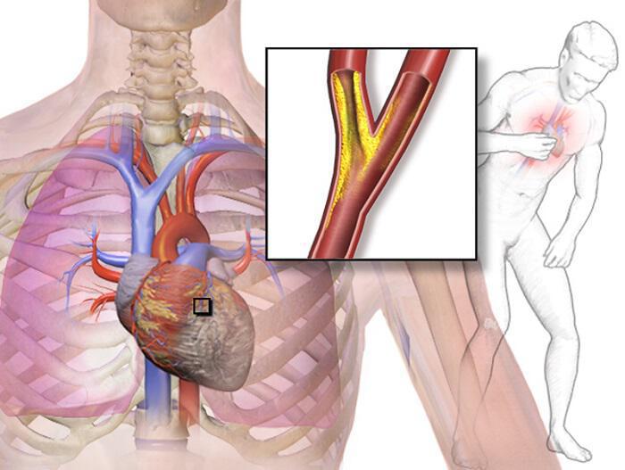 Καρδιαγγειακό: Πως να διατηρήσετε την ελαστικότητα των αγγείων σας