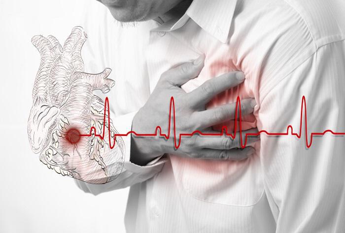 Καρδιακή προσβολή: Ένα πρώιμο σημάδι εμφράγματος που ελάχιστοι γνωρίζουν