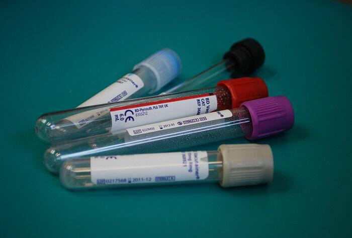 Εξετάσεις αίματος: Πως να τις αποκωδικοποιήσετε