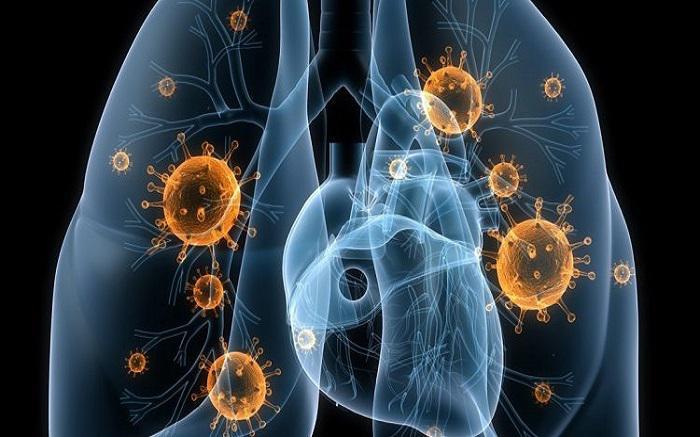 Επιπλοκές κοροναϊού: Τι πρέπει να γνωρίζουμε για την πνευμονία