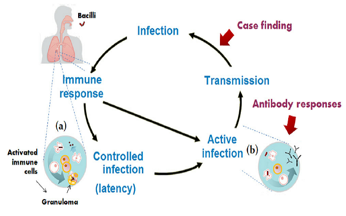 Φυματίωση: Τι είναι, πώς εκδηλώνεται-Συμπτώματα, πώς κολλάει, πρόληψη
