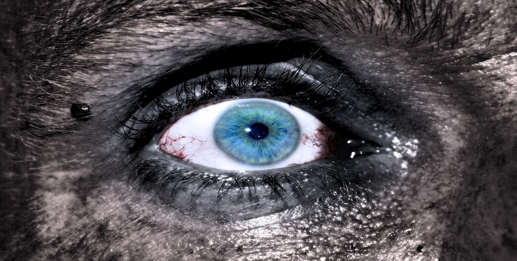 Τα μάτια μπορούν να σηματοδοτήσουν καρδιακές παθήσεις-Τι να παρατηρήσετε