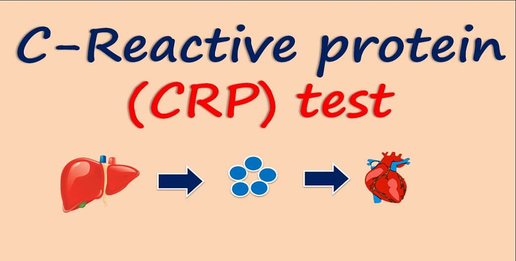 C-αντιδρώσα πρωτεΐνη-CRP: Αιτίες αύξησης, επιπτώσεις και αντιμετώπιση