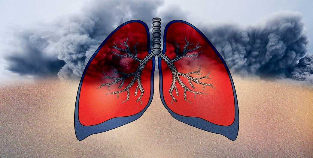 Ποιά σημάδια υποδεικνύουν συσσώρευση υγρού στον πνεύμονα