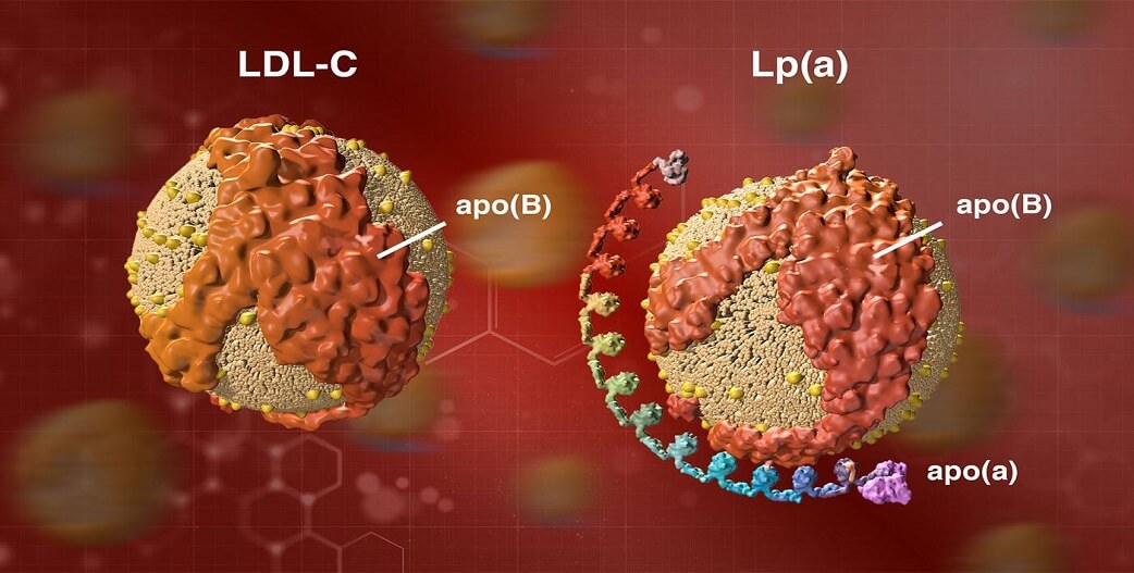 Λιποπρωτεΐνη «Α»-Lp(a) χοληστερόλη: Ποιοί παράγοντες την καθιστούν επικίνδυνη