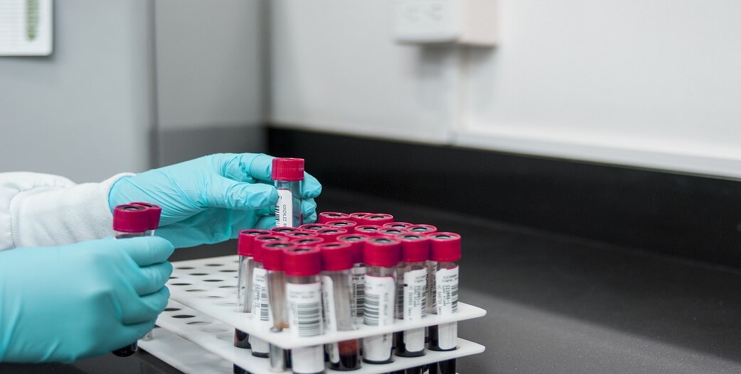 Galleri: Τεστ αίματος ανιχνεύει πάνω από 50 είδη καρκίνου