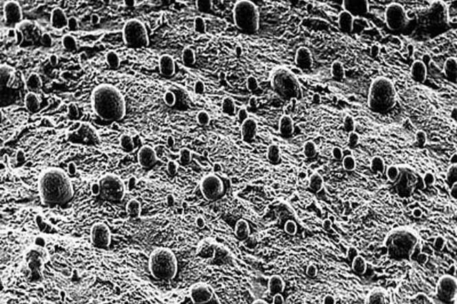 Απίθανες φωτογραφίες: Το ανθρώπινο σώμα στο μικροσκόπιο